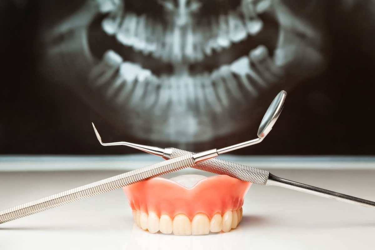 Открытка рентген челюсти  с днем стоматолога   Тіс дәрігері күні құтты болсын 